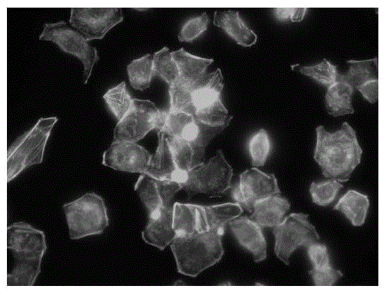 Application of toremifene citrate in the preparation of drugs for inhibiting tumor cell metastasis and spread