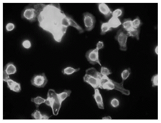 Application of toremifene citrate in the preparation of drugs for inhibiting tumor cell metastasis and spread