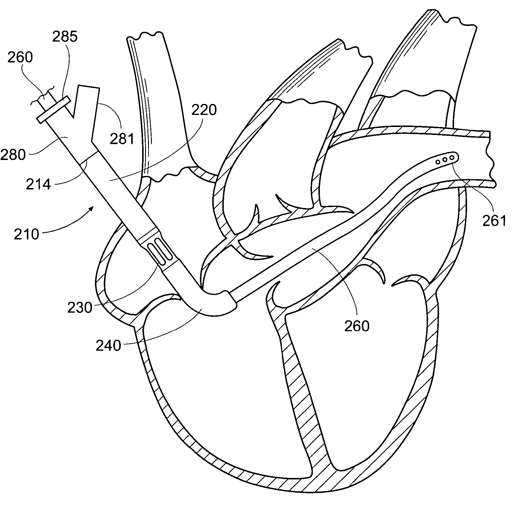 Apparatus and methods for entering cavities of the body