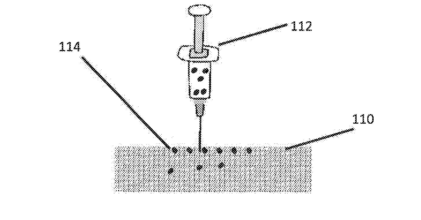 Compositions, methods and devices for local drug delivery