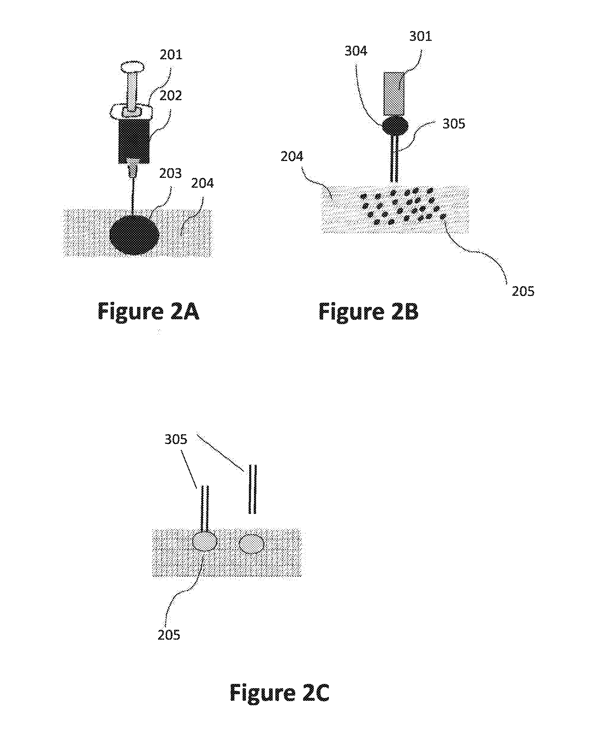 Compositions, methods and devices for local drug delivery