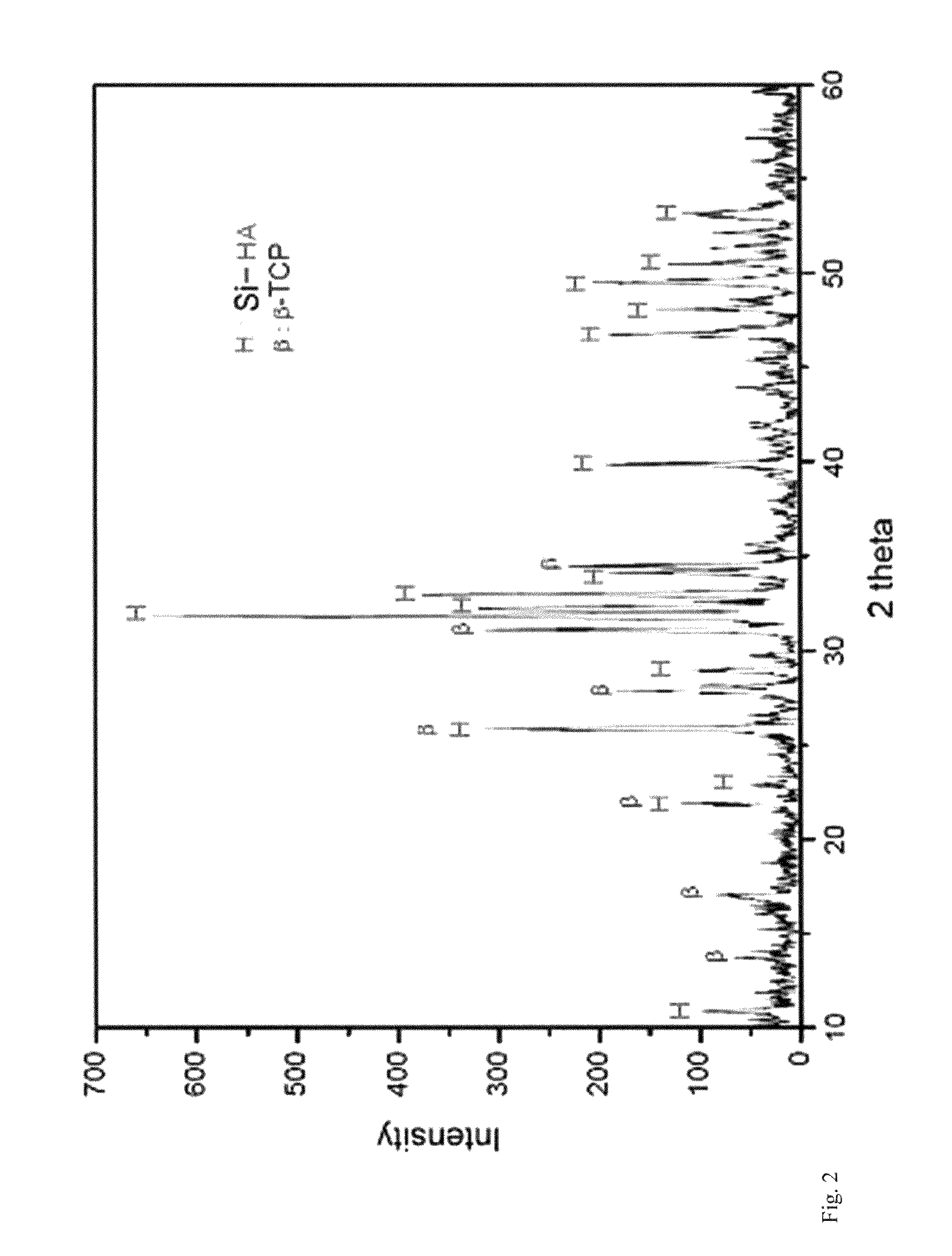 Porous composite comprising silicon-substituted hydroxyapatite and ß- tricalcium phosphate, and process for preparing the same