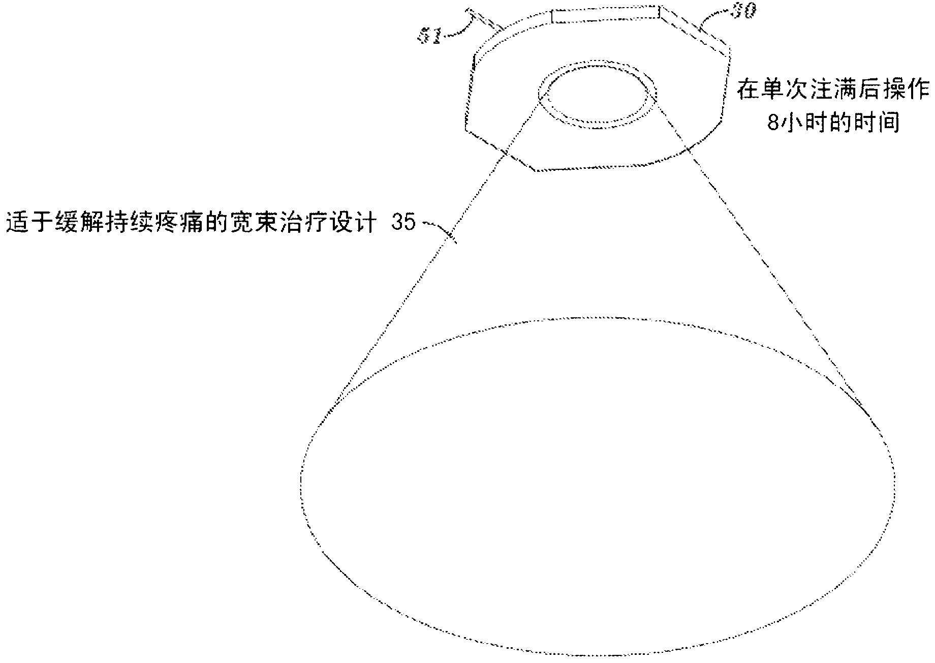 Hydrogel ultrasound coupling device