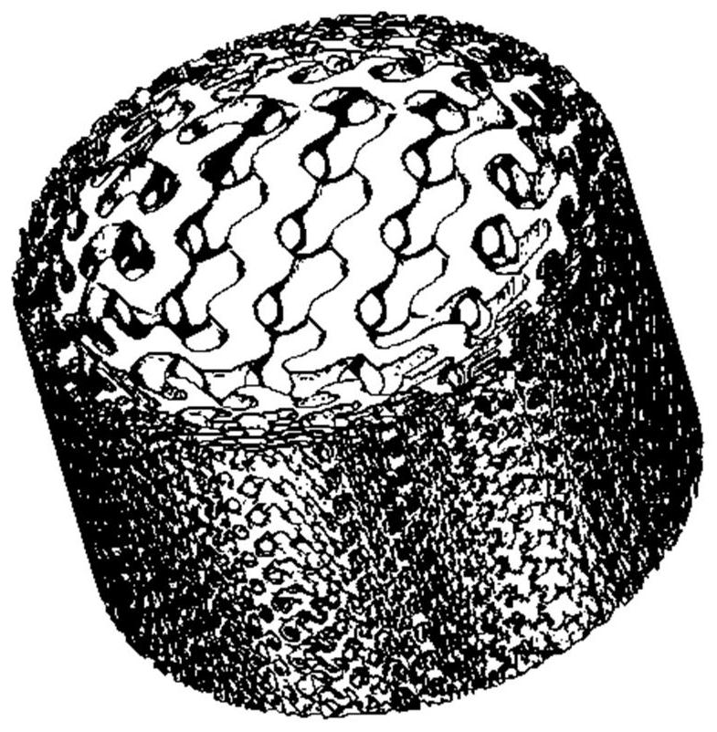 A Bone Tissue Gradient Scaffold with Adjustable Degradation Speed ​​and Its Forming Method Based on 3D Printing