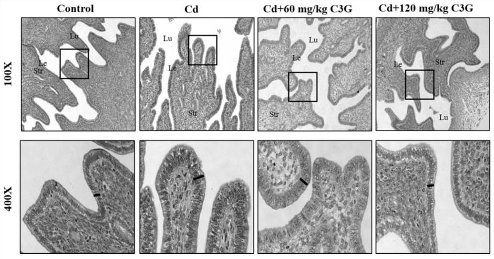 Application of cyanidin-3-O-glucoside in preparation of medicine for treating and/or preventing endometrial hyperplasia disease