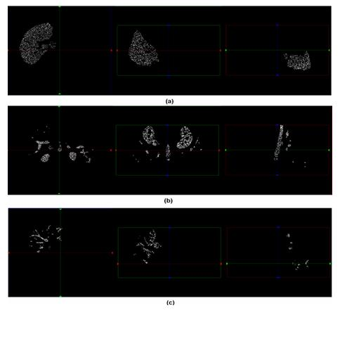 Segmentation method of viscera and internal blood vessels thereof in surgical planning system