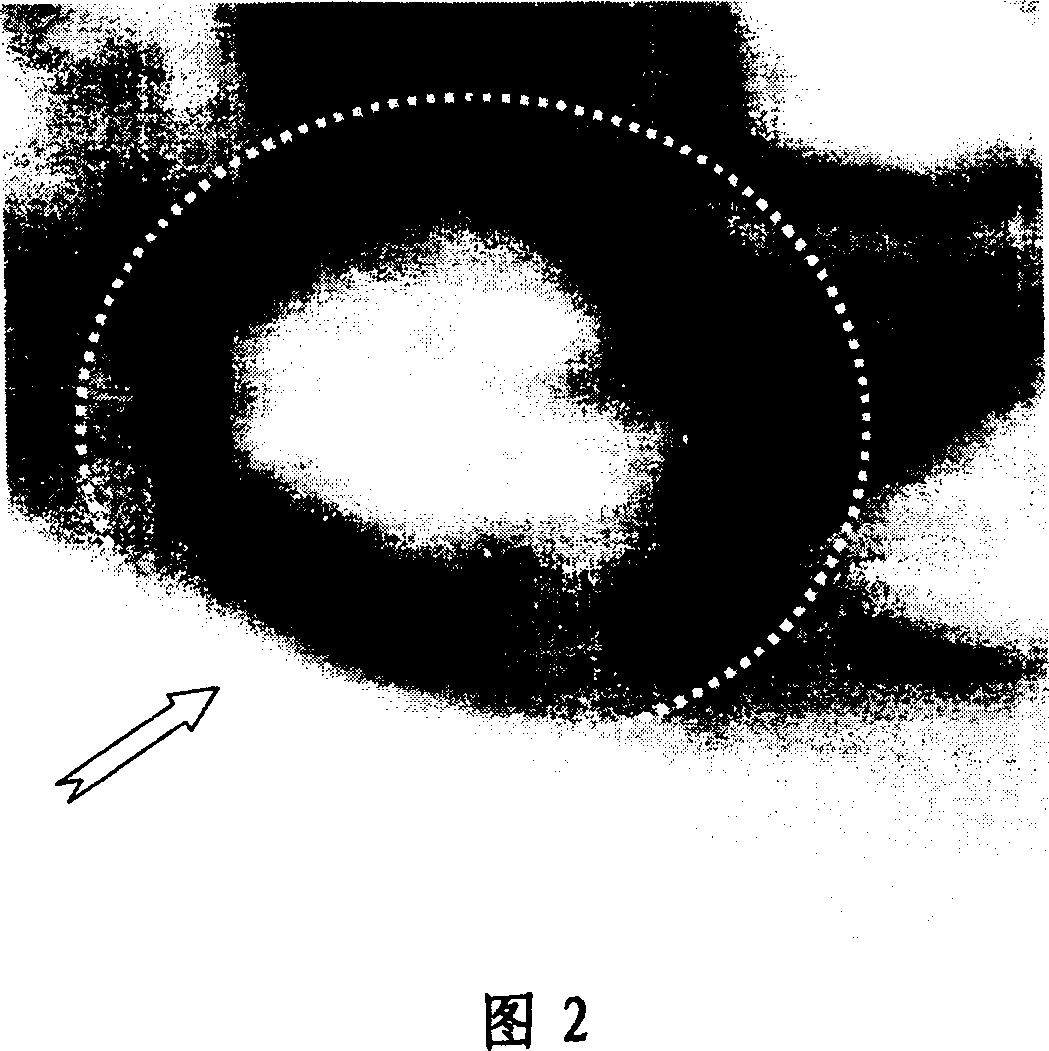 Process for preparing foam composite material of magnesium alloy-pearlite