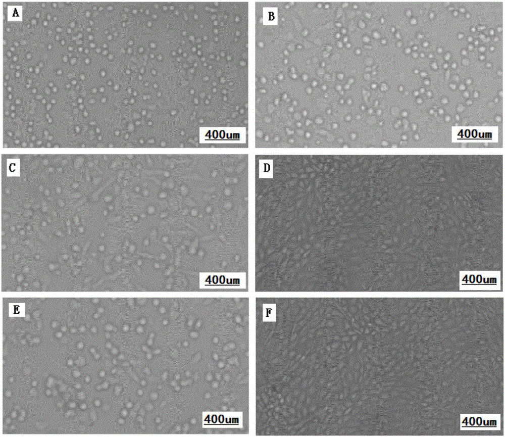 Goatpox, sheeppox and contagious ecthyma triple cell attenuated vaccine and preparation method and application thereof