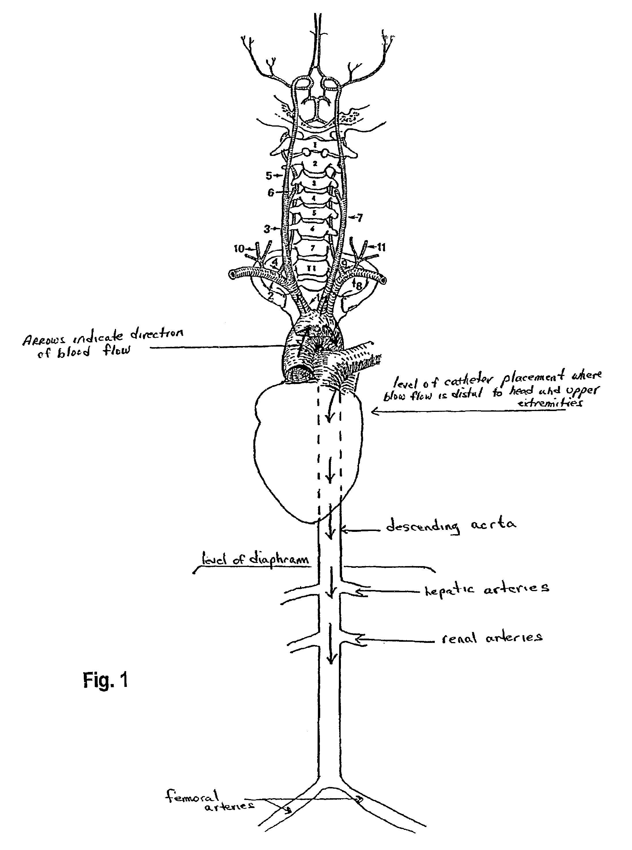 Administration of a thiol-based chemoprotectant compound