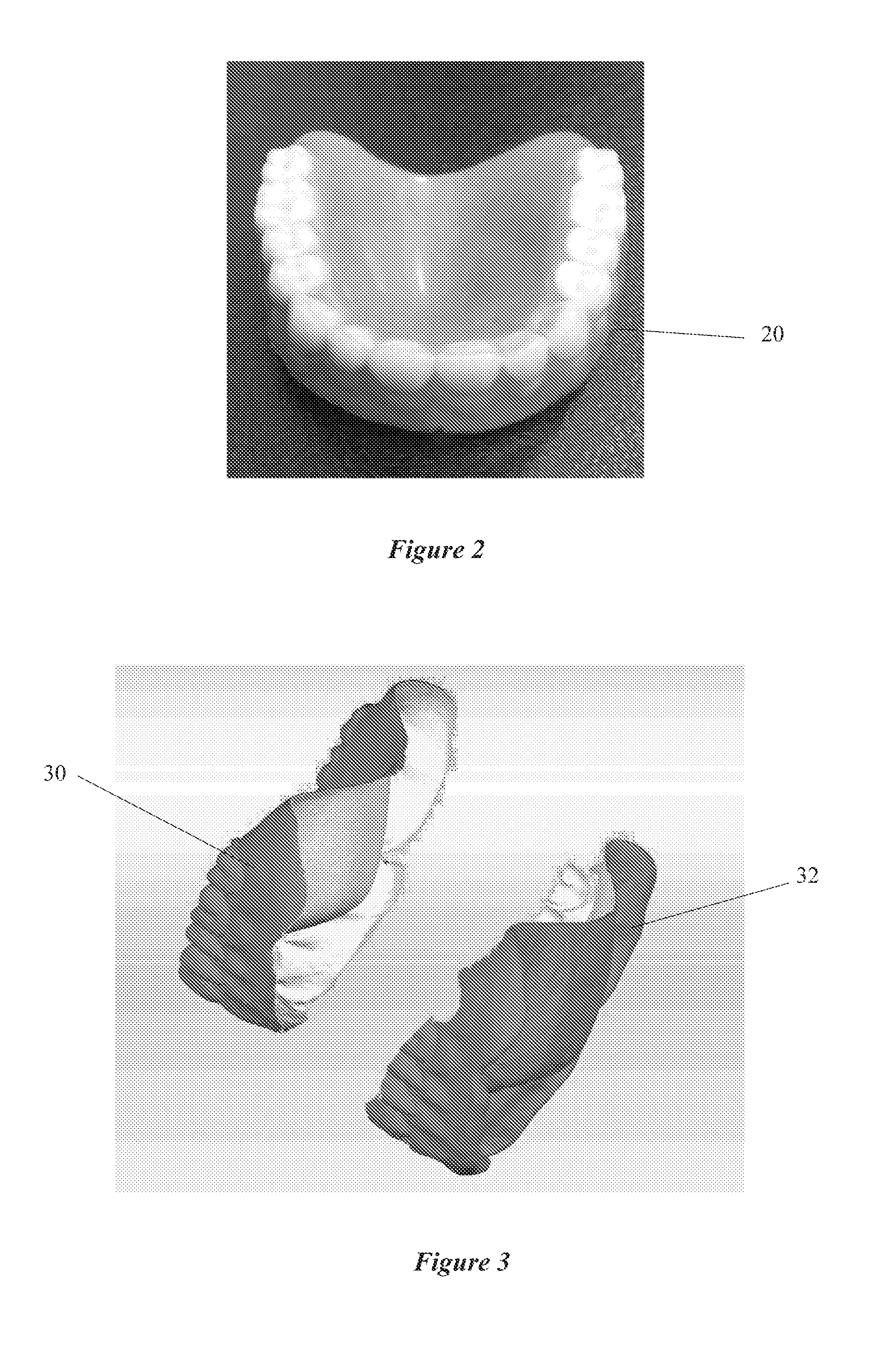 System and process for duplication of dentures