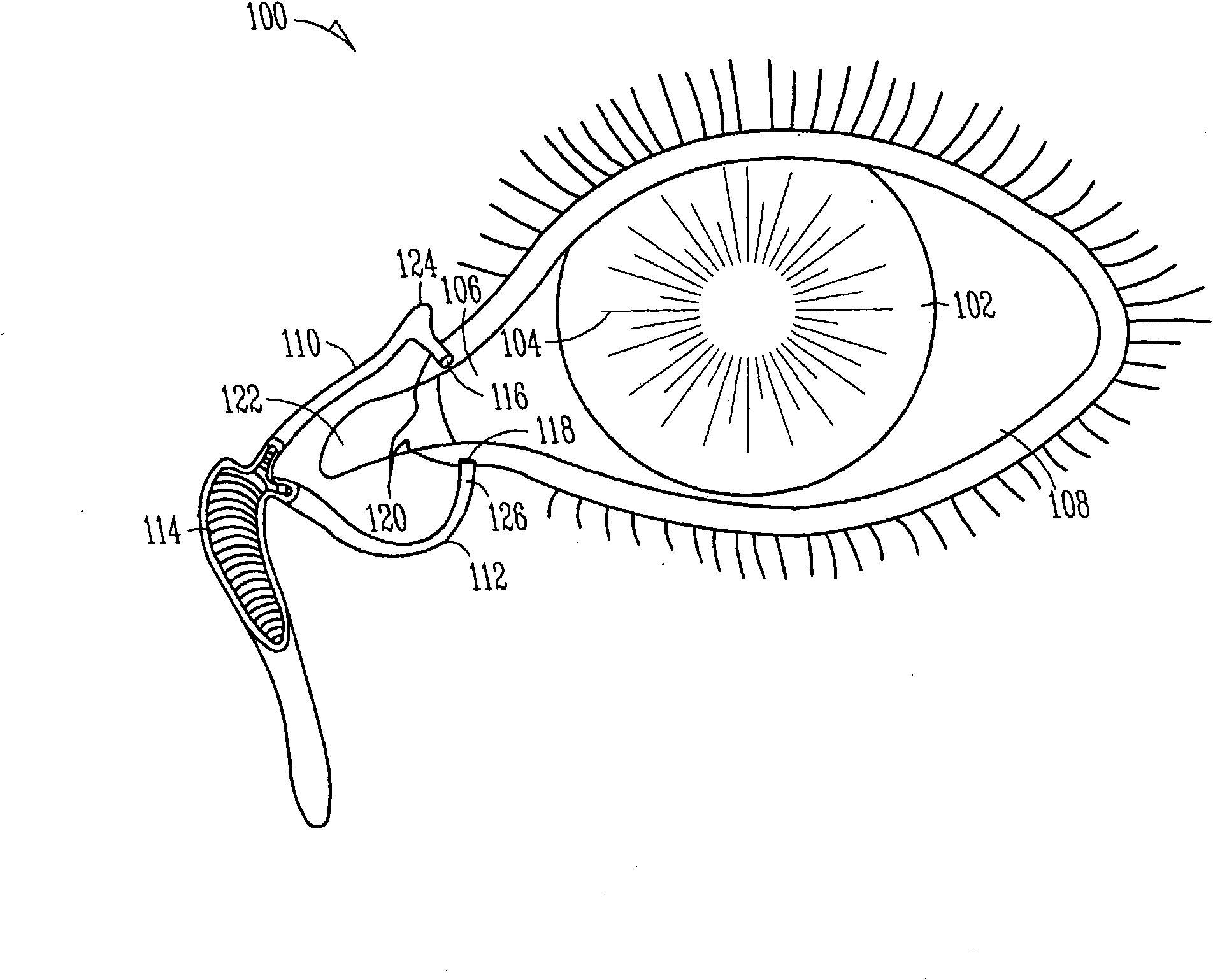 Lacrimal implants and related methods