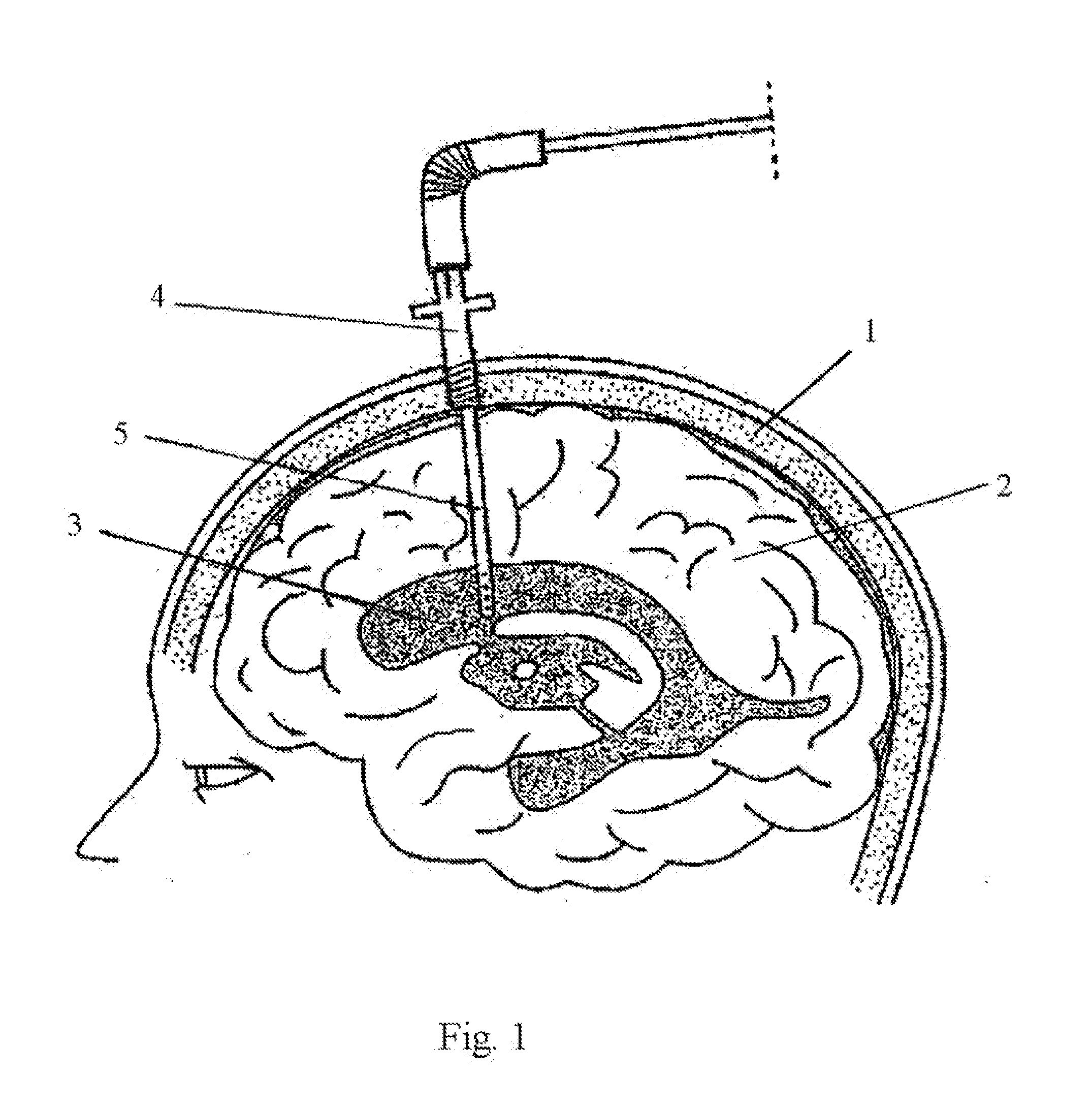 Central Nervous System Drain