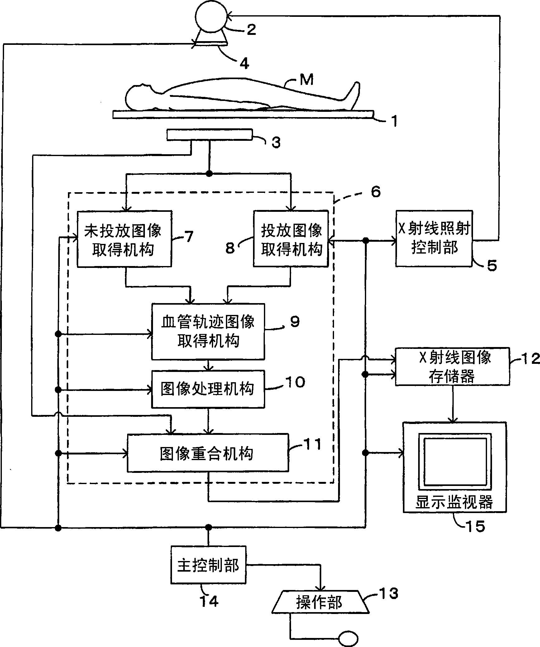 Radiographic apparatus