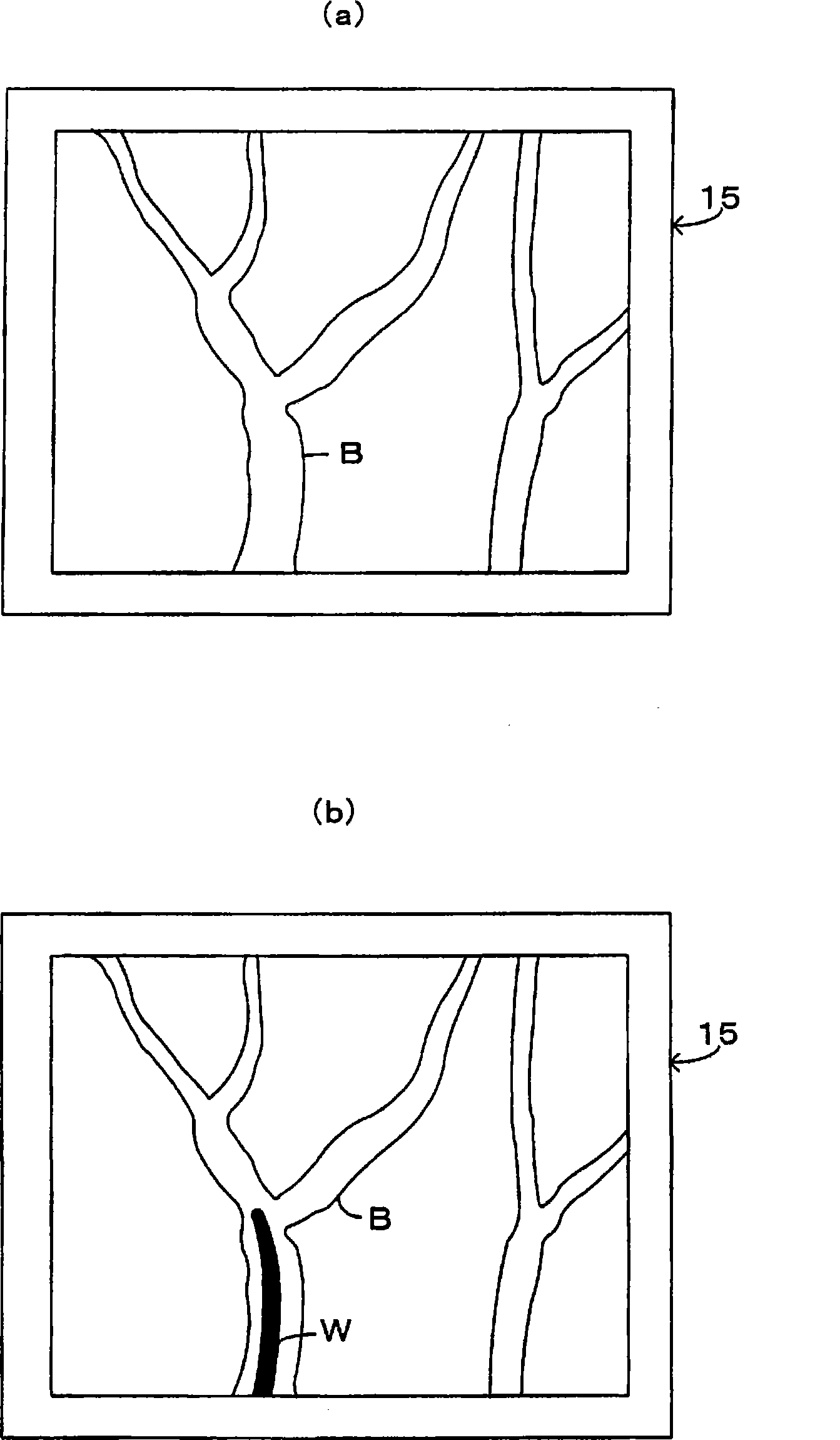 Radiographic apparatus