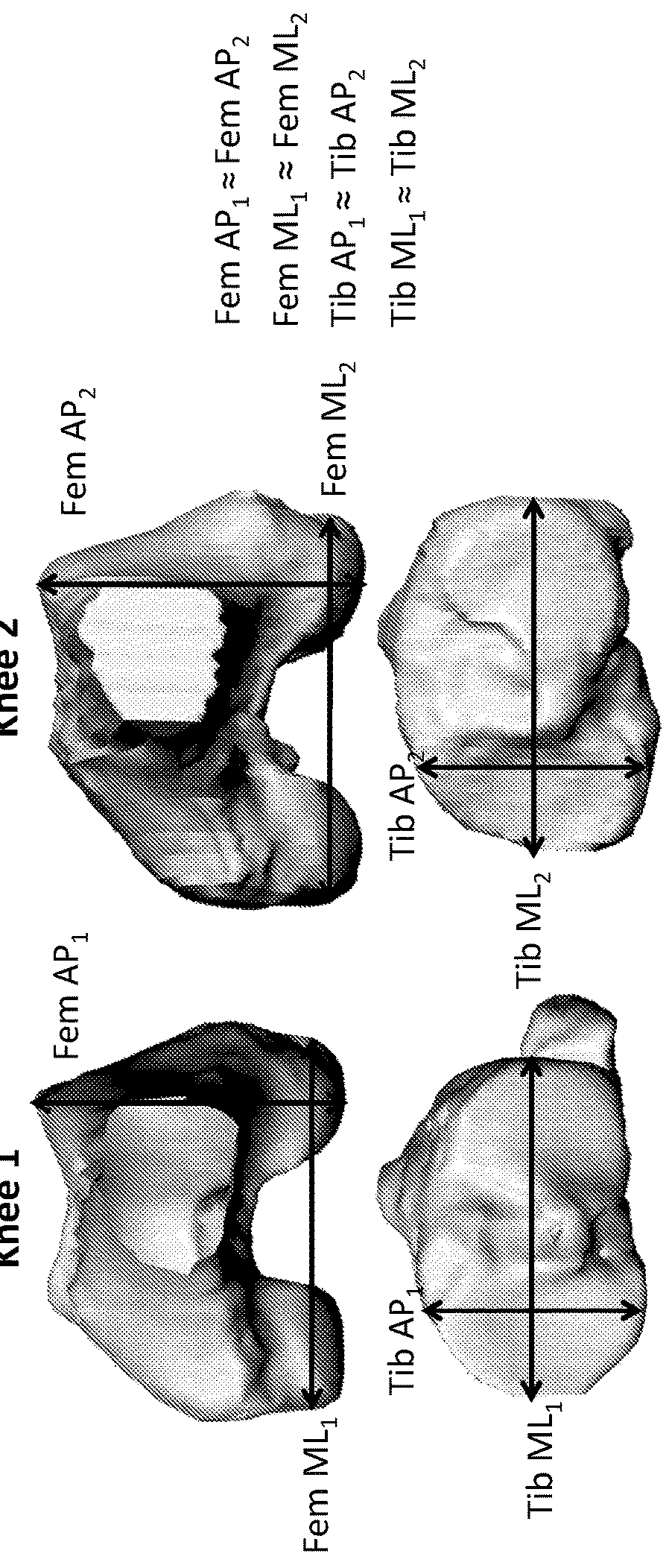 Systems and methods of implants to restore patient specific functon