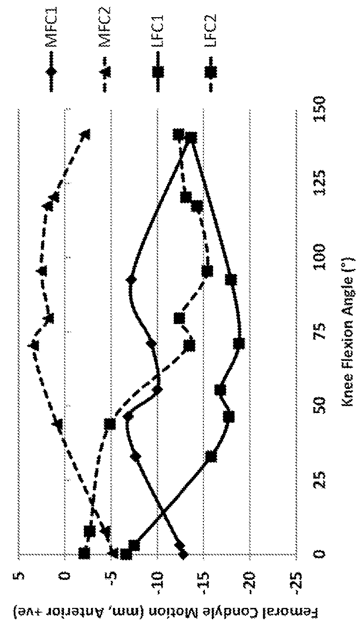 Systems and methods of implants to restore patient specific functon