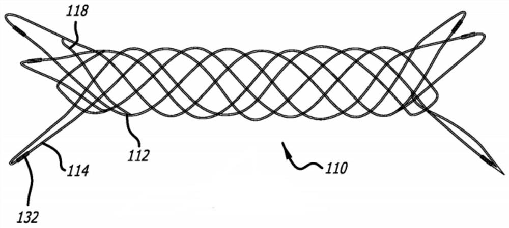 Radiopaque vascular prosthesis