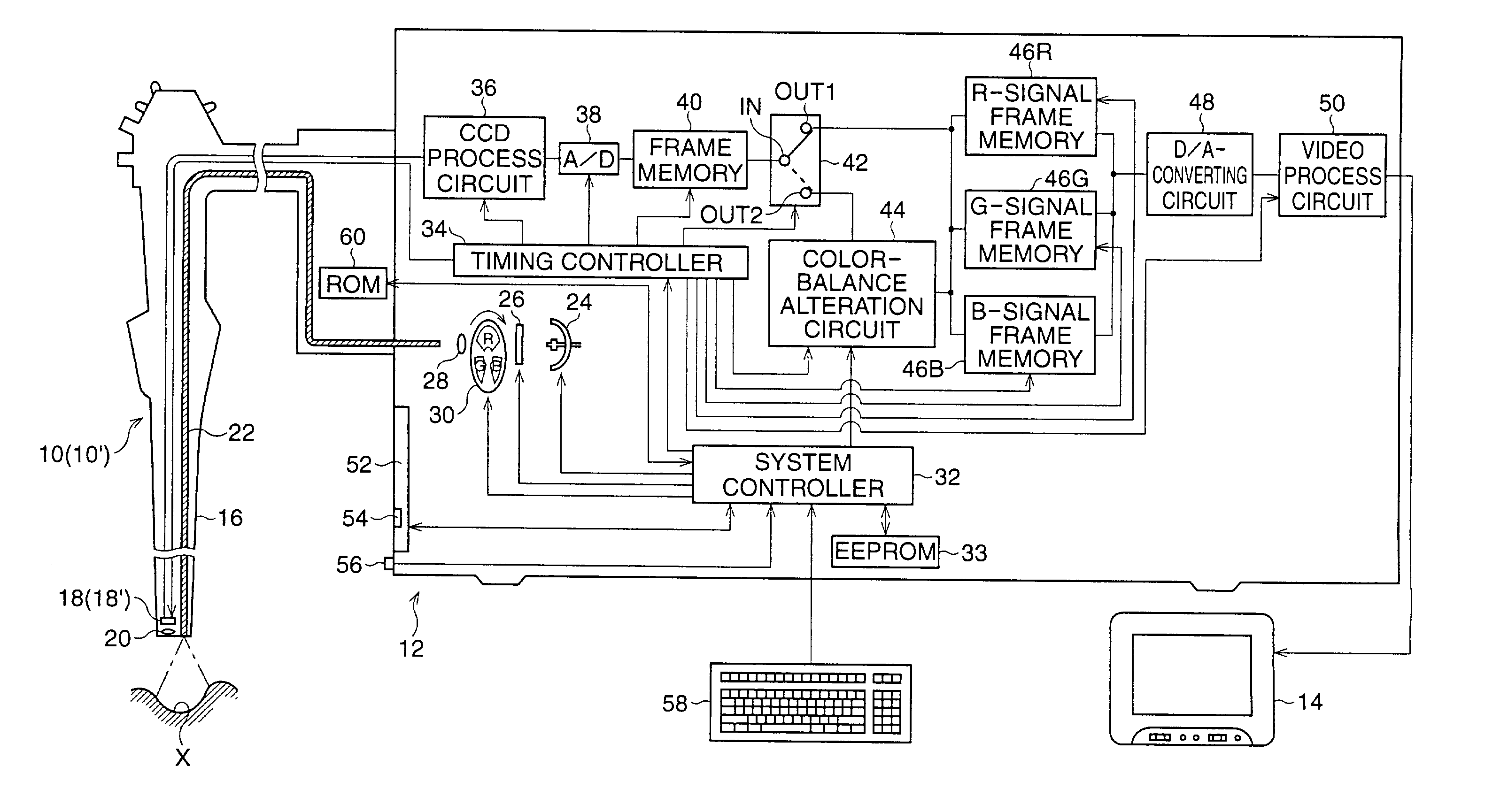 Electronic endoscope system with color-balance alteration process