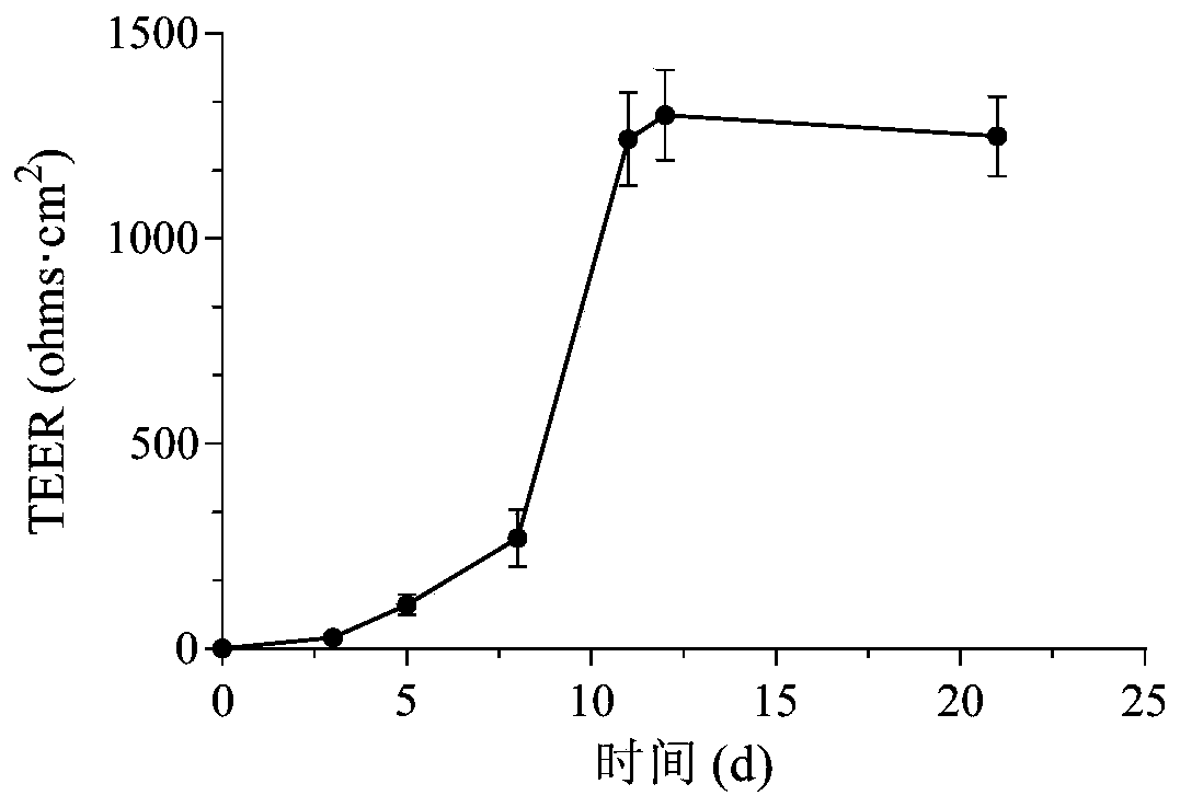 Bifidobacterium animal and application thereof in controlling diabetes or hyperlipidemia, particularly in weight gain or obesity