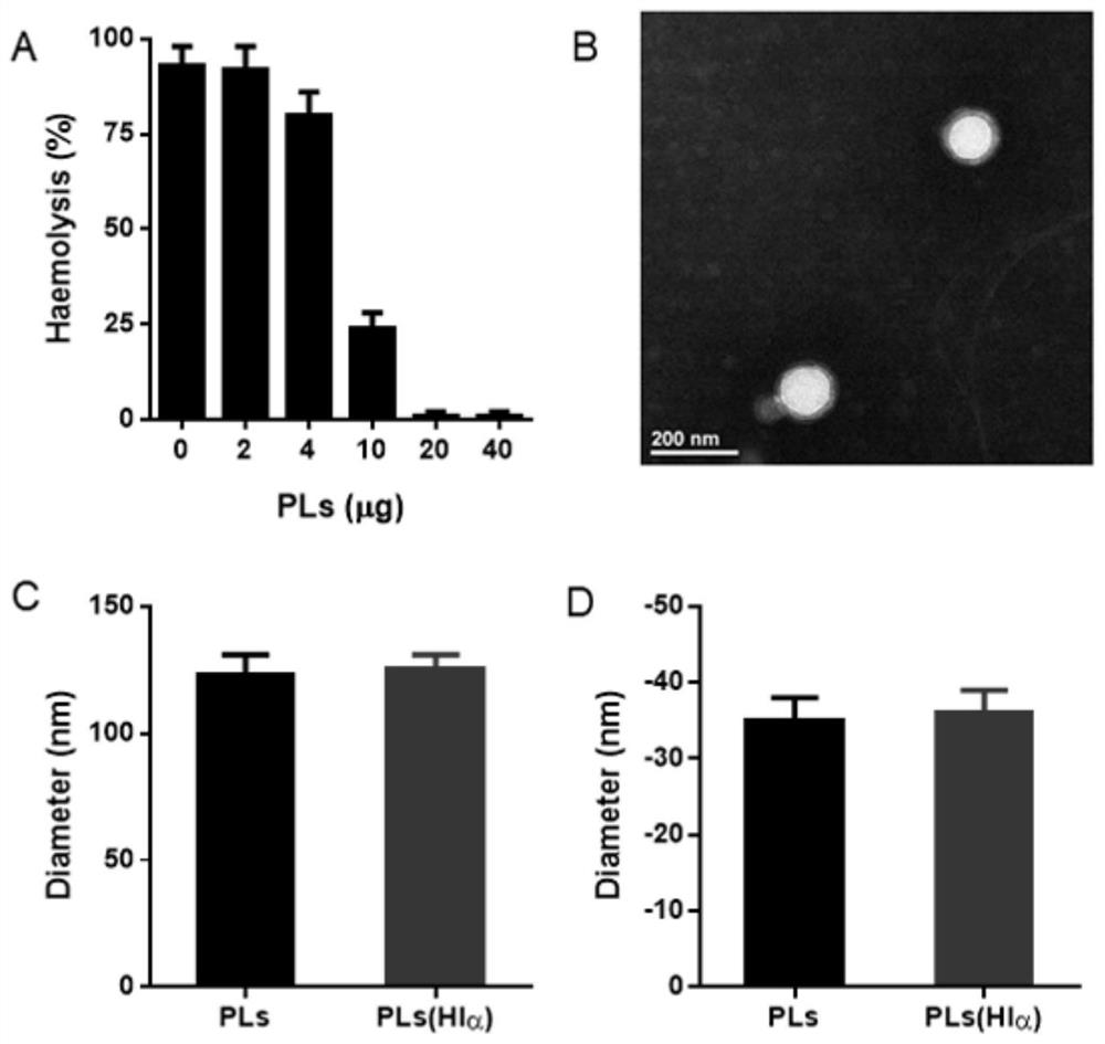 Bacterial toxin vaccine and application thereof in preventing bacterial infection