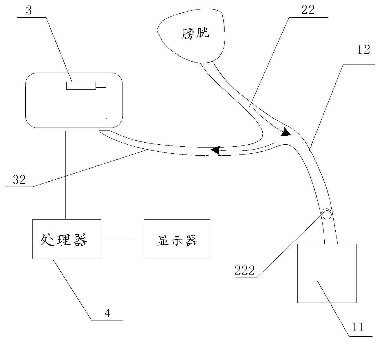 Urethral catheterization device and abdominal pressure monitoring system