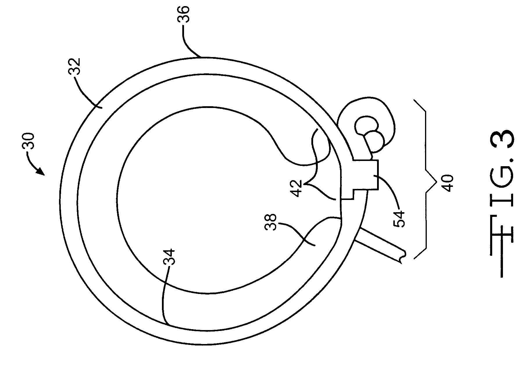 Implantable band having improved attachment mechanism