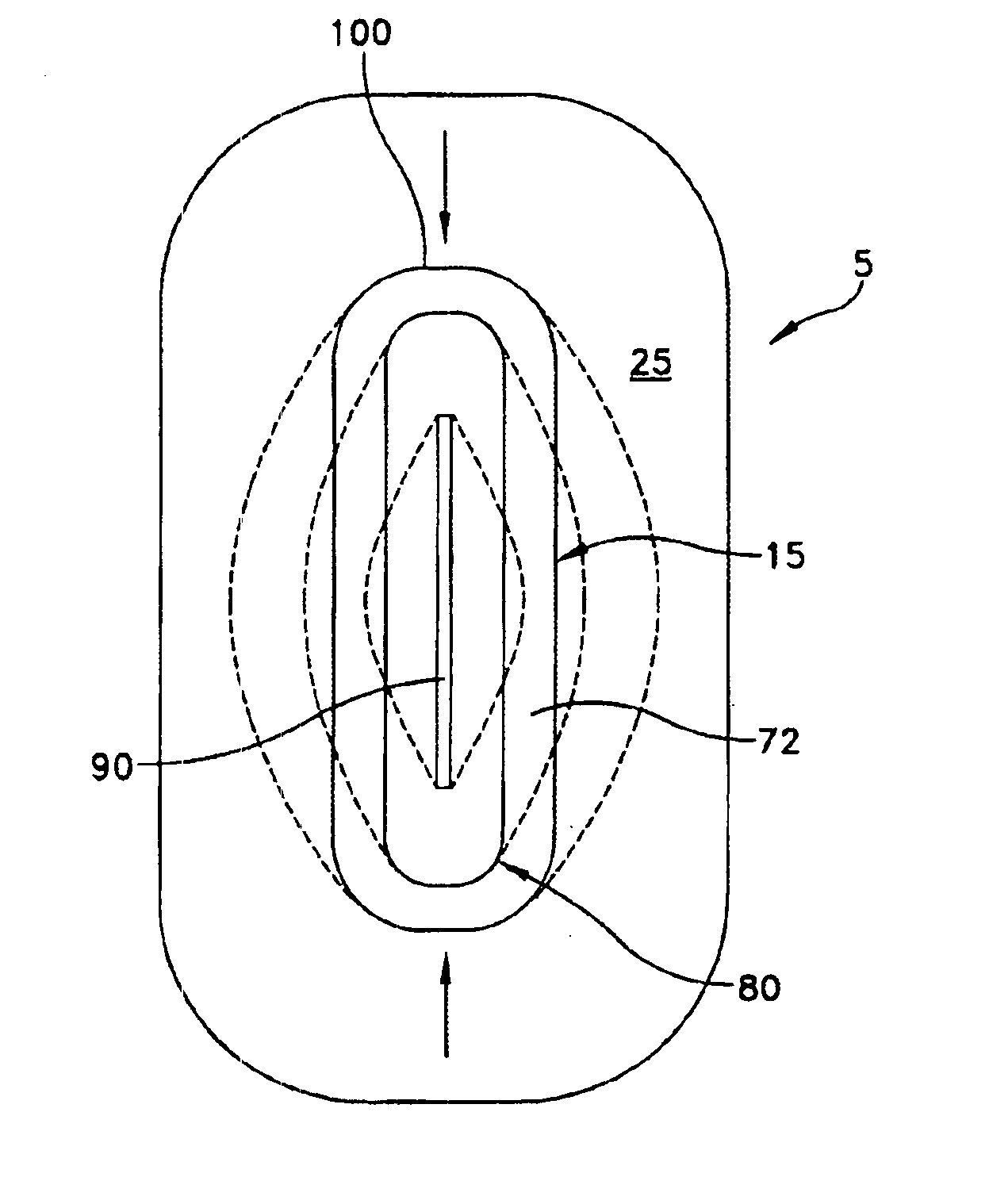 Intracardiovascular access (ICVATM) system