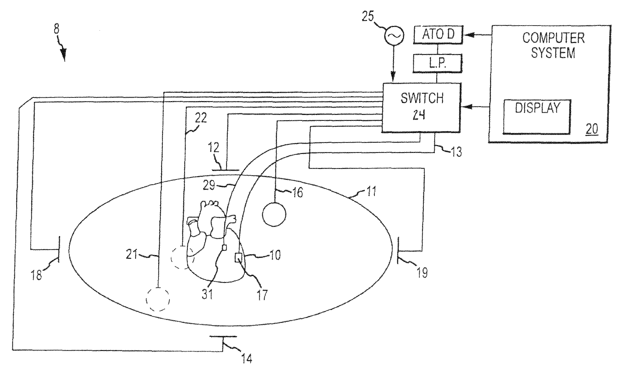 Method and system for identifying cardiac arrhythmia driver sites