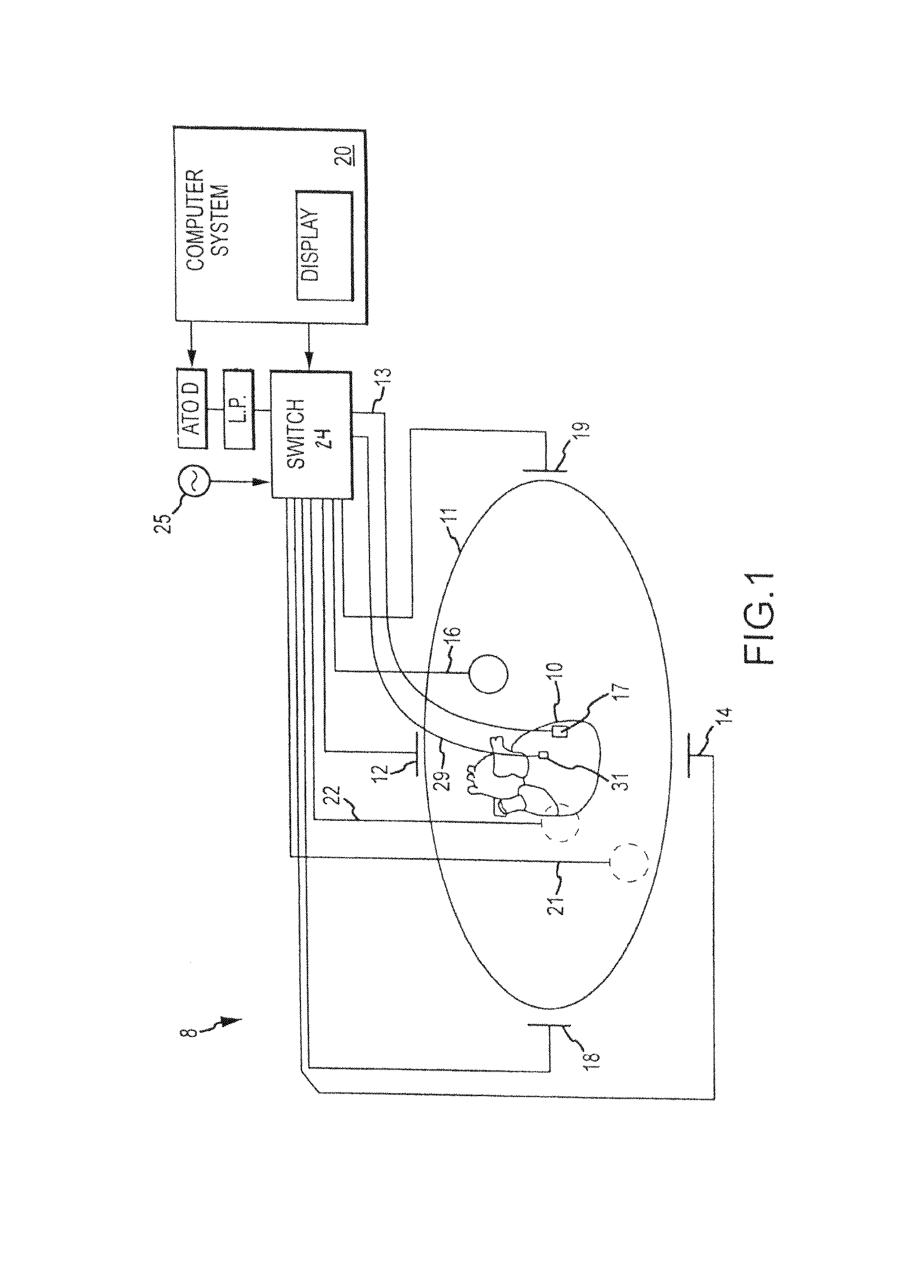 Method and system for identifying cardiac arrhythmia driver sites