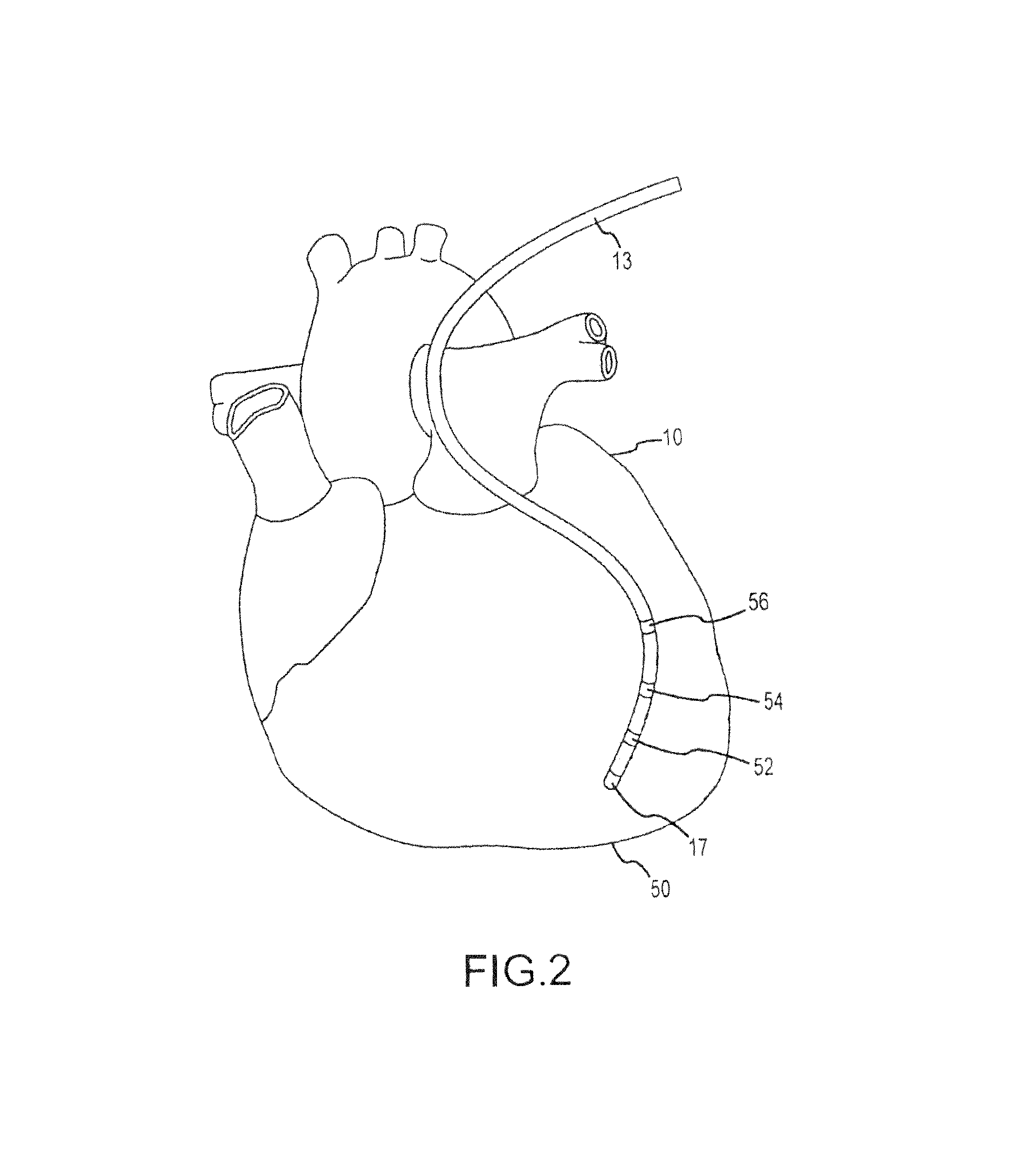 Method and system for identifying cardiac arrhythmia driver sites