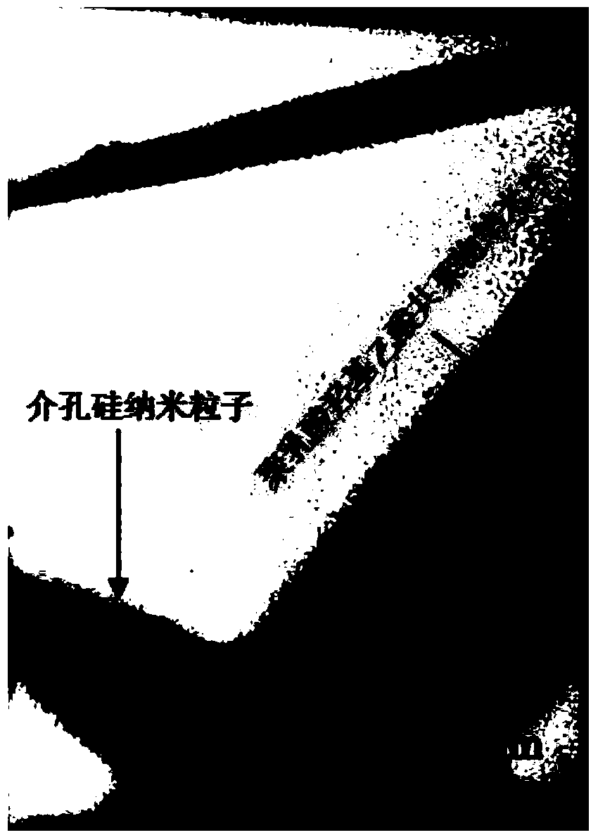 Preparation method of inorganic/organic multi-drug controlled release composite nano fiber scaffold