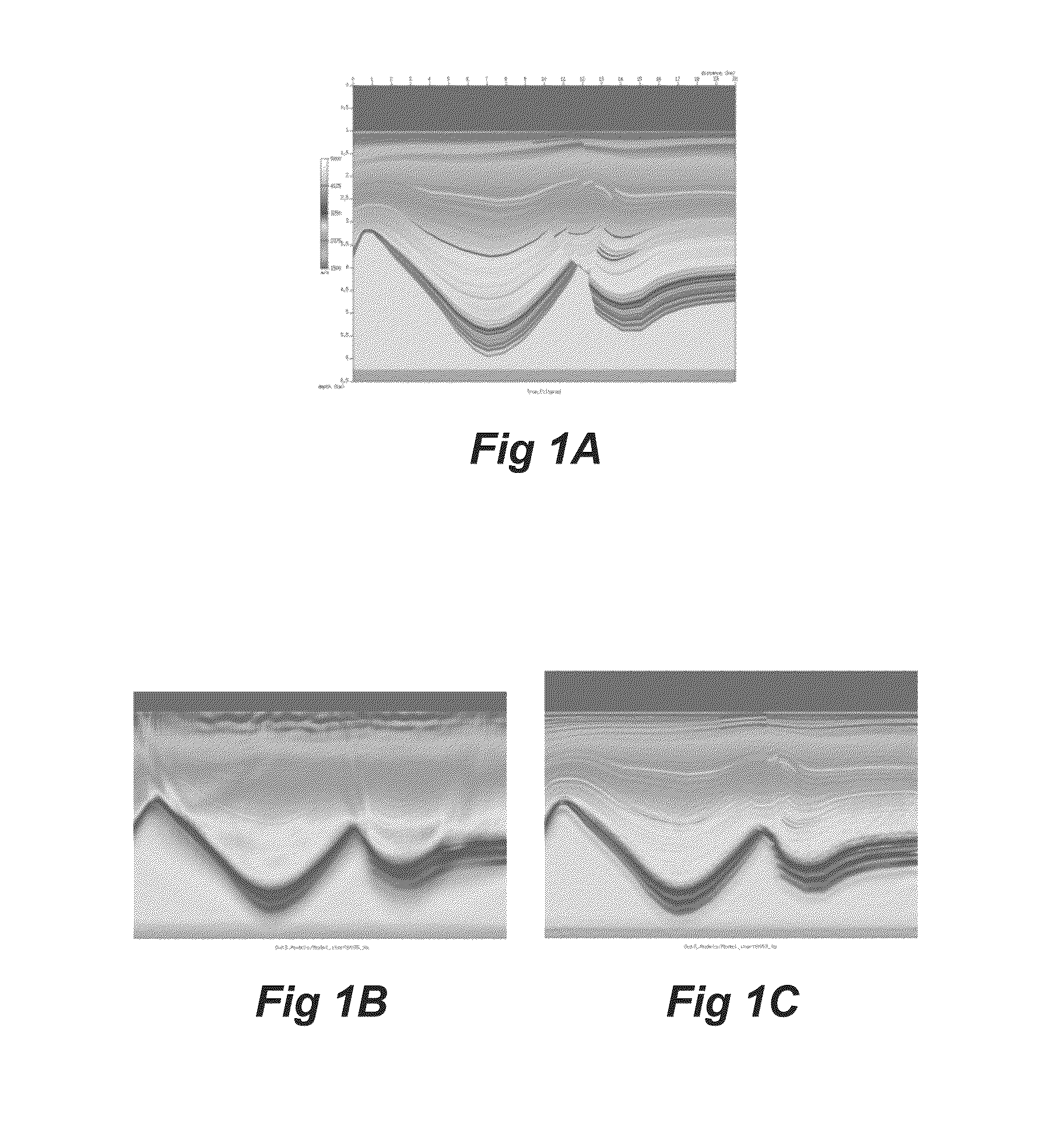 Simultaneous source inversion for marine streamer data with cross-correlation objective function