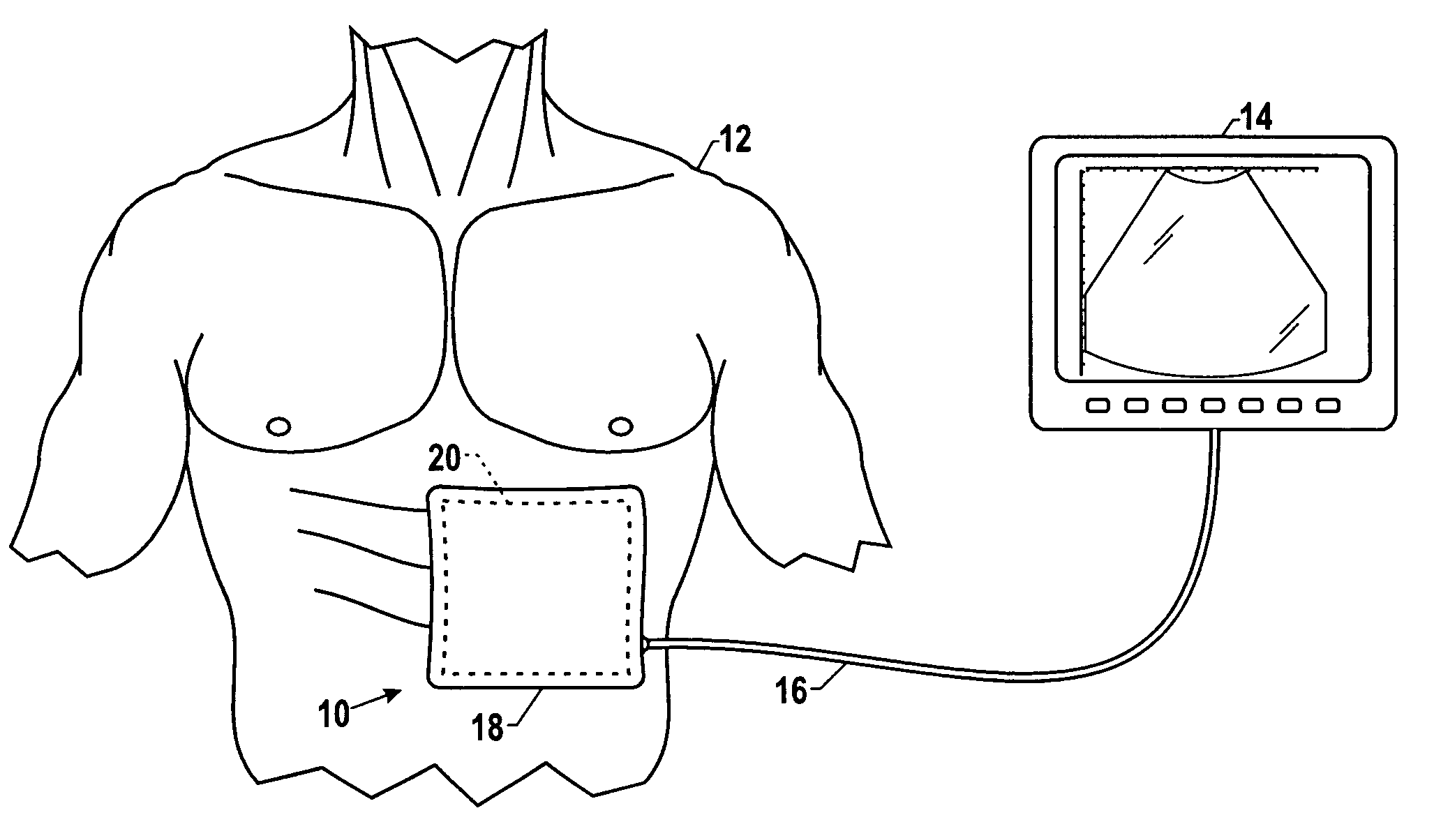 Systems and methods for operating a two-dimensional transducer array