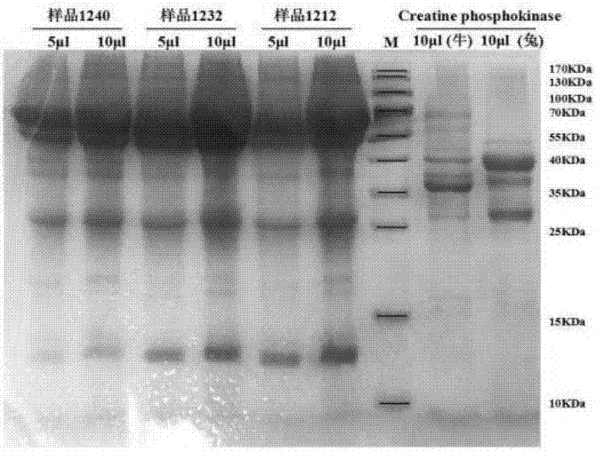 Bovine derived creatine kinase isoenzyme double-antibody sandwich ELISA (enzyme-linked immuno sorbent assay) rapid detection kit