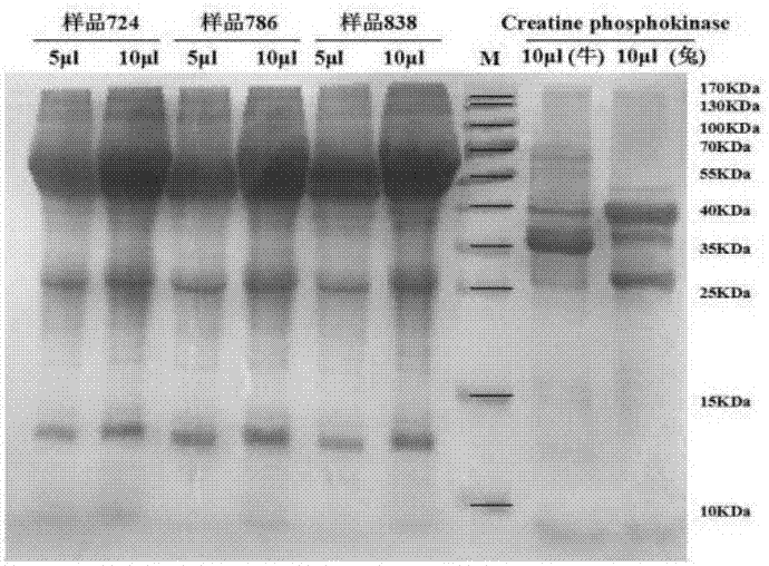 Bovine derived creatine kinase isoenzyme double-antibody sandwich ELISA (enzyme-linked immuno sorbent assay) rapid detection kit