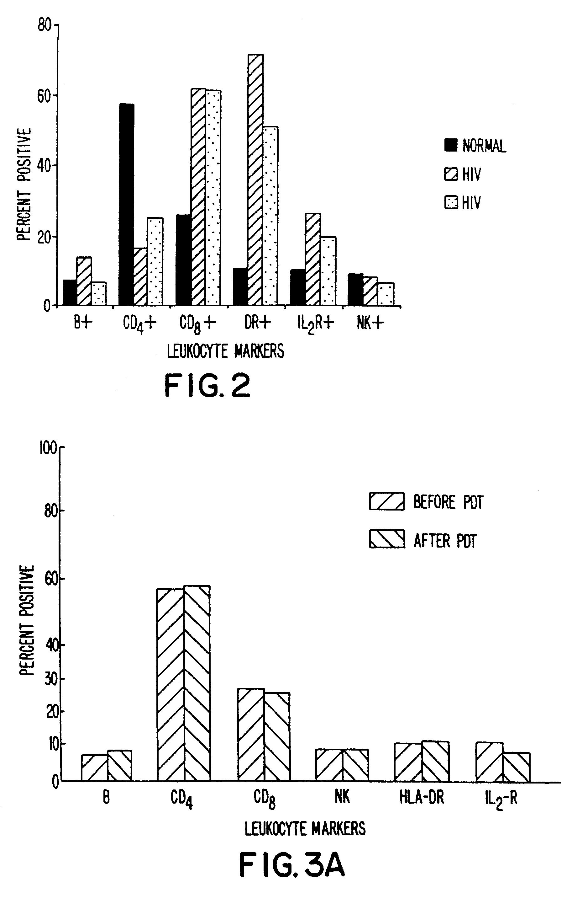 Photodynamic therapy in selective cell inactivation in blood and treating immune dysfunction diseases