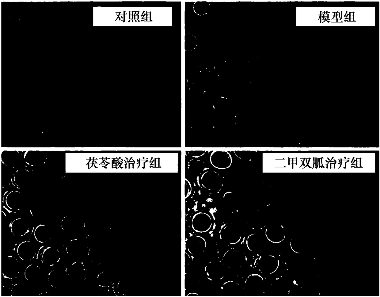 Application of pachymic acid or pachymic acid derivative in preparing medicine for treating polycystic ovary syndrome and medicinal preparation