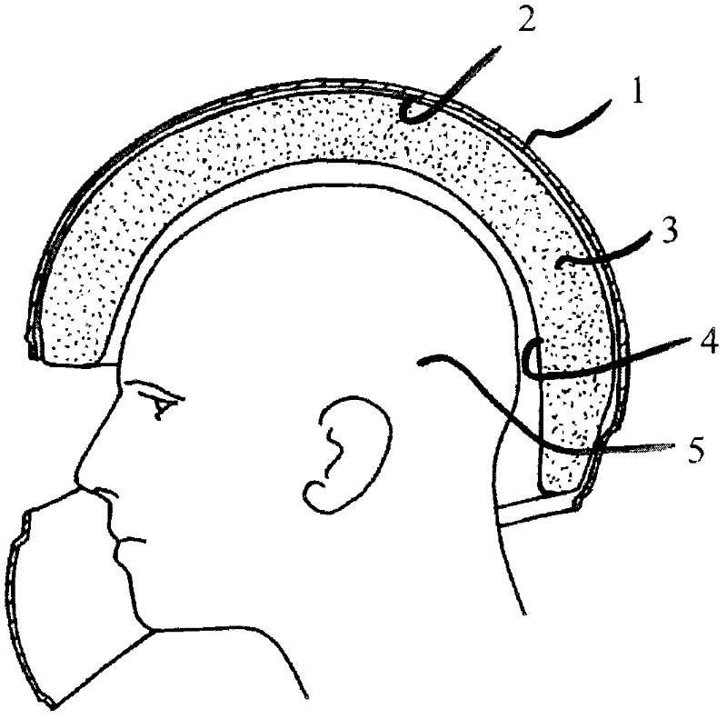 Protective helmet and method for mitigating or preventing head injury