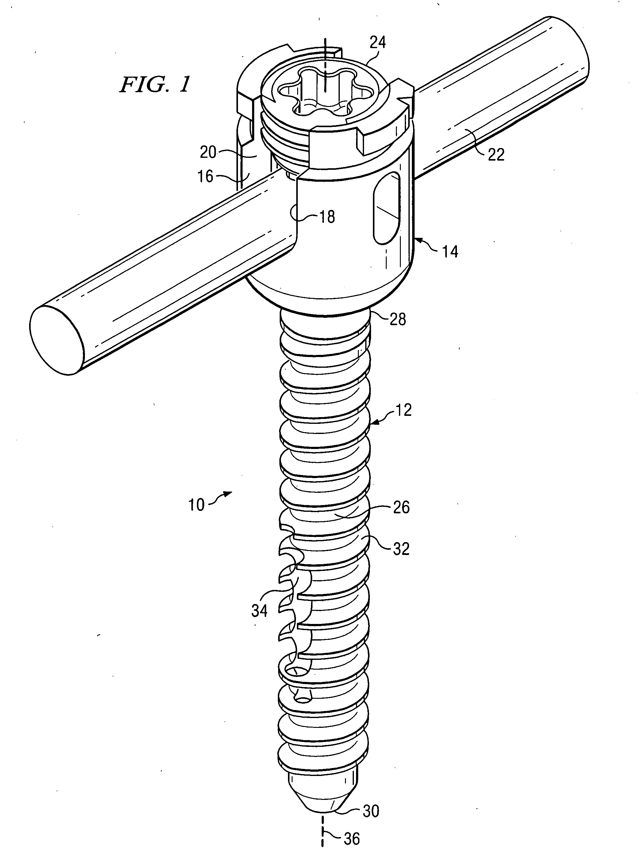 Off-axis anchor guidance system