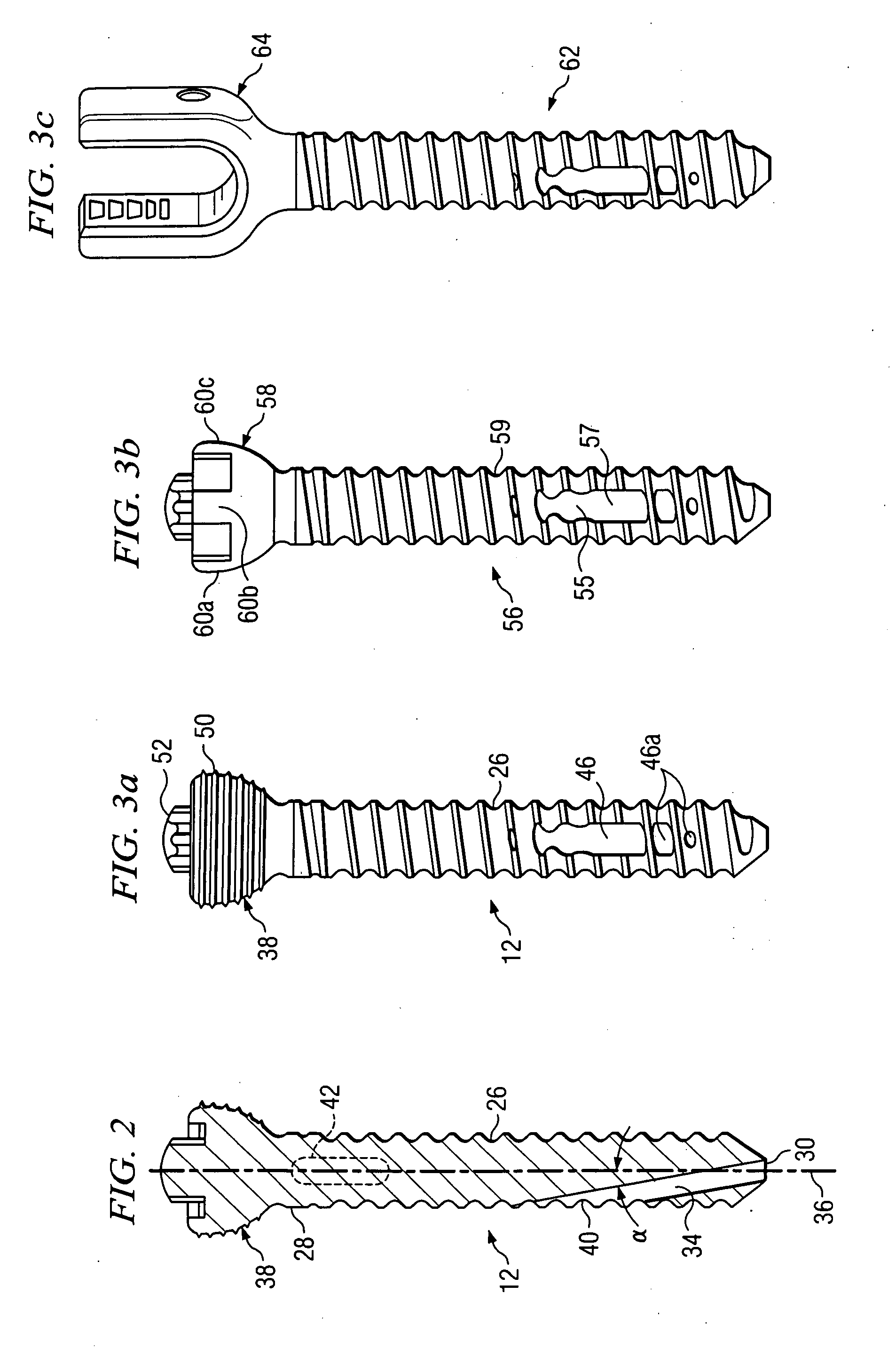 Off-axis anchor guidance system