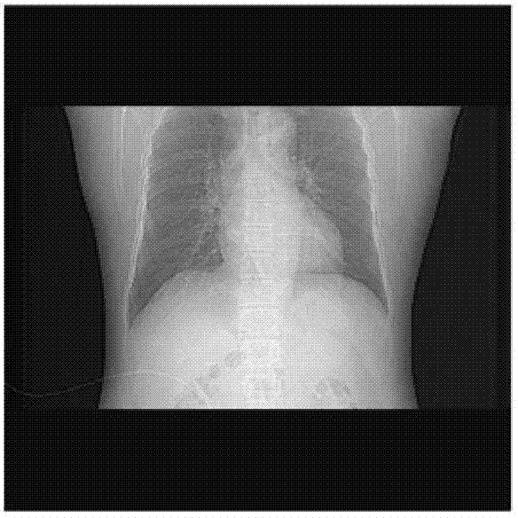 Automatic heart locating method based on chest locating film