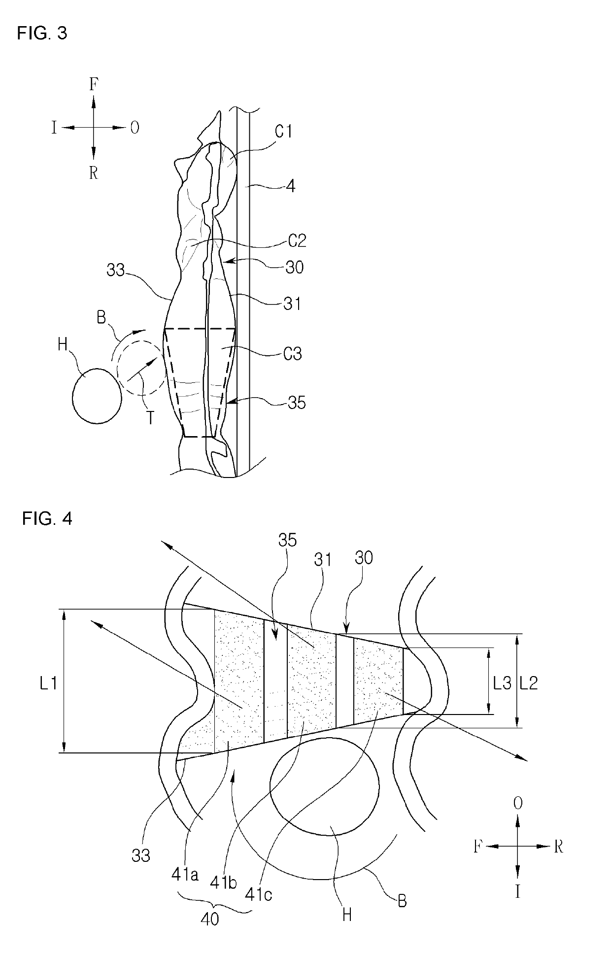 Curtain airbag of vehicle