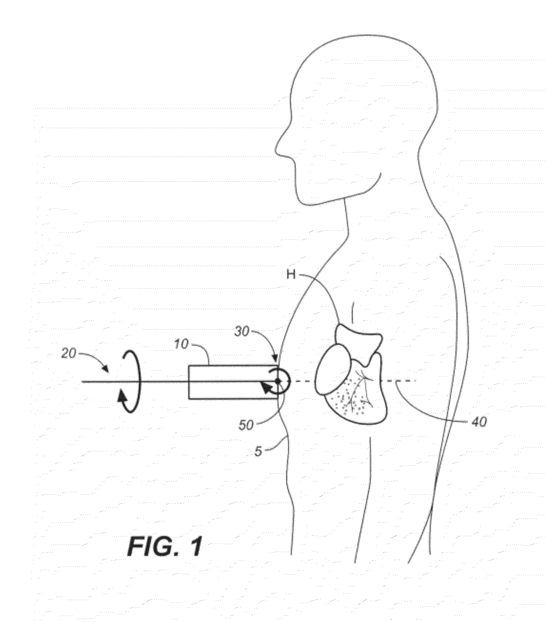 Method and Apparatus to Visualize the Coronary Arteries Using  Ultrasound