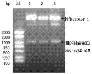 RGD-recombinatn staphylokinase-human alpha microglobulin fusion protein, and preparation method and application thereof