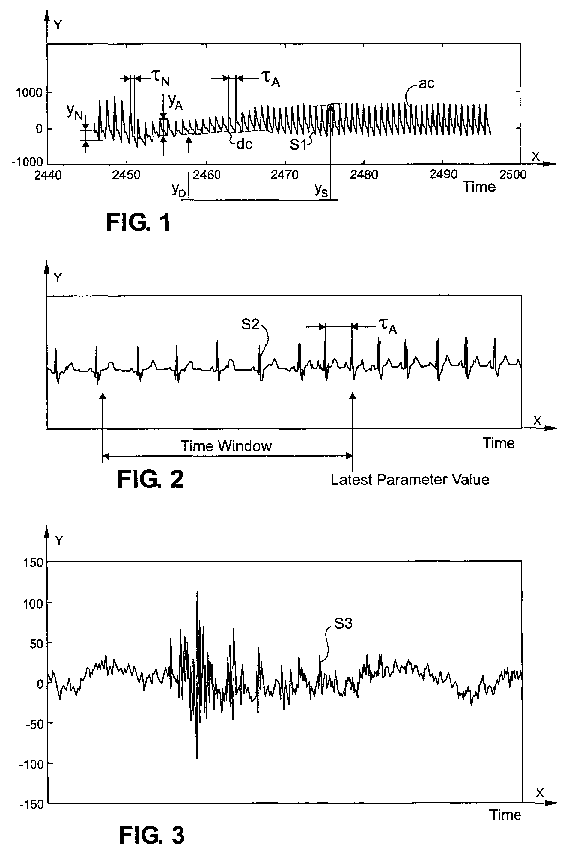 Method and apparatus based on combination of physiological parameters for assessment of analgesia during anesthesia or sedation