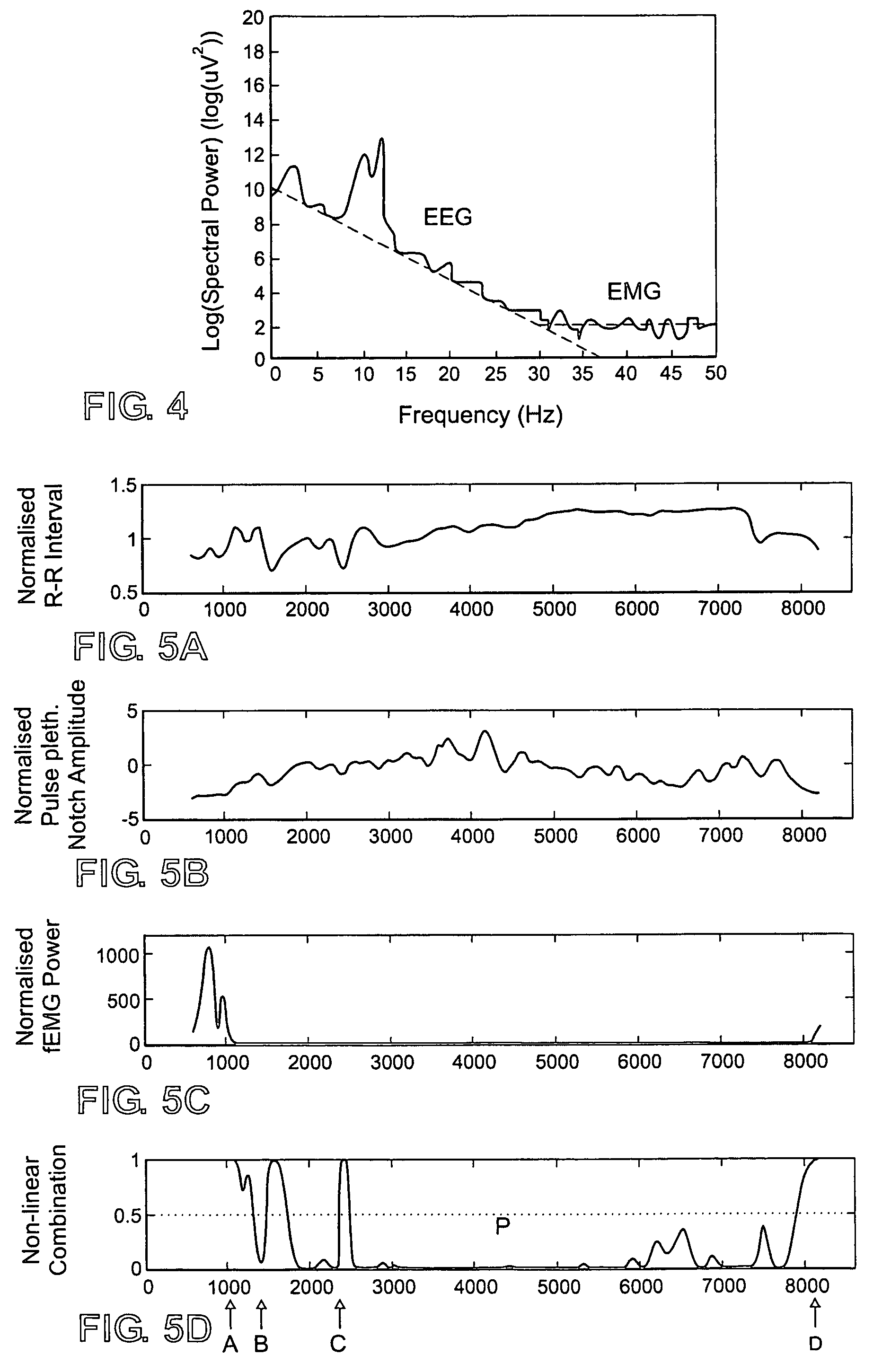 Method and apparatus based on combination of physiological parameters for assessment of analgesia during anesthesia or sedation