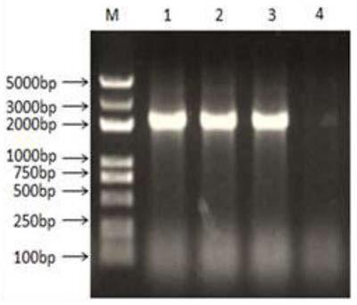 Flaggelin-fiber2 fusion protein, and preparation method and application thereof