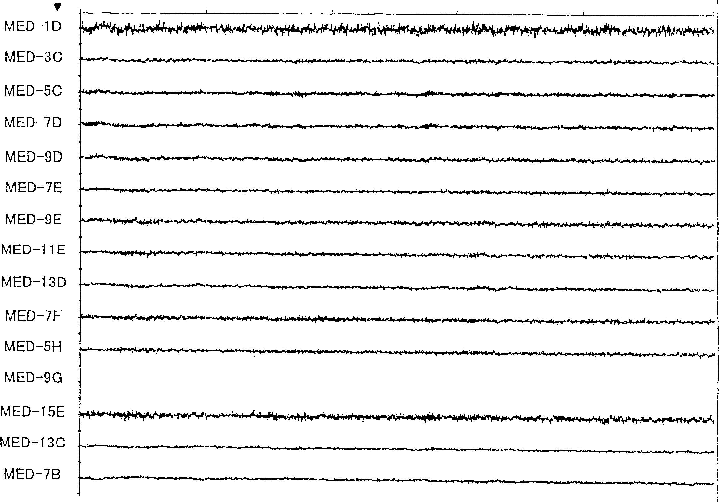 Magnetoencephalography device and method of using the same