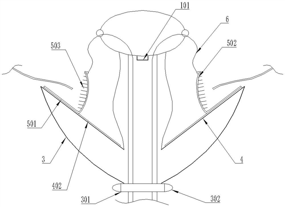 Cardiac apex implantation cuspid valve clamping device and cardiac apex implantation cuspid valve clamping method