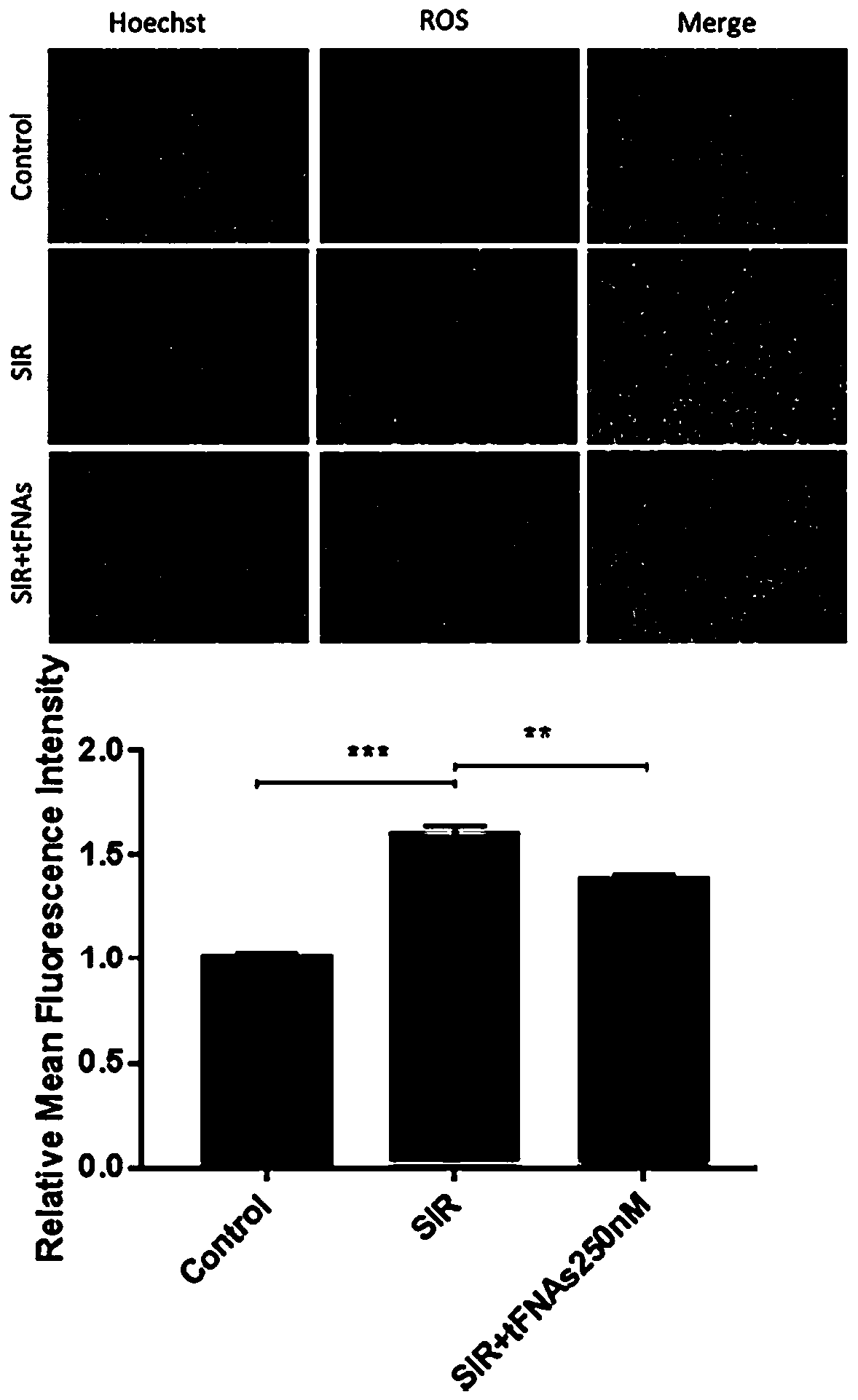 Drug for preventing and treating myocardial ischemia reperfusion injury or treating cardiac ischemic diseases